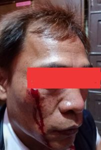‎Tak Terima Pemberitaan, Oknum Kontraktor Aniaya Wartawan Pagaralam