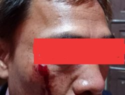 ‎Tak Terima Pemberitaan, Oknum Kontraktor Aniaya Wartawan Pagaralam